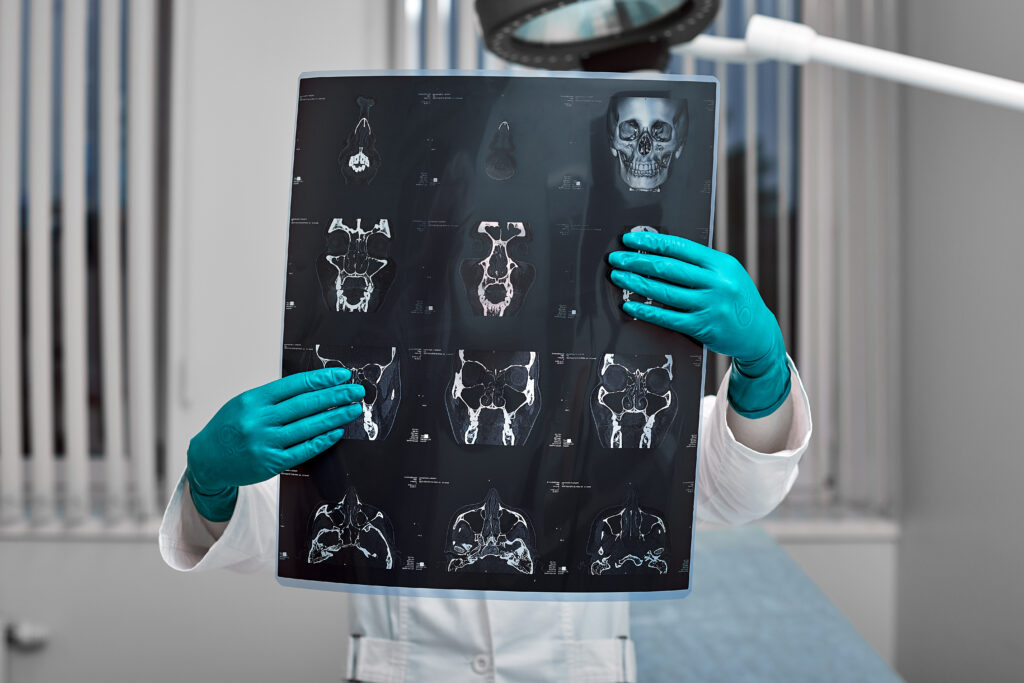 Doctor attentively examines the MRI scan of the patient. thumbnail
