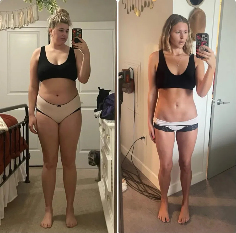 Real Results: Weight Loss Stories from Miami Beach thumbnail