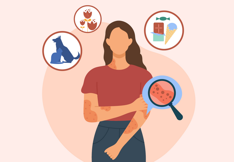 How to Handle an Allergic Reaction thumbnail