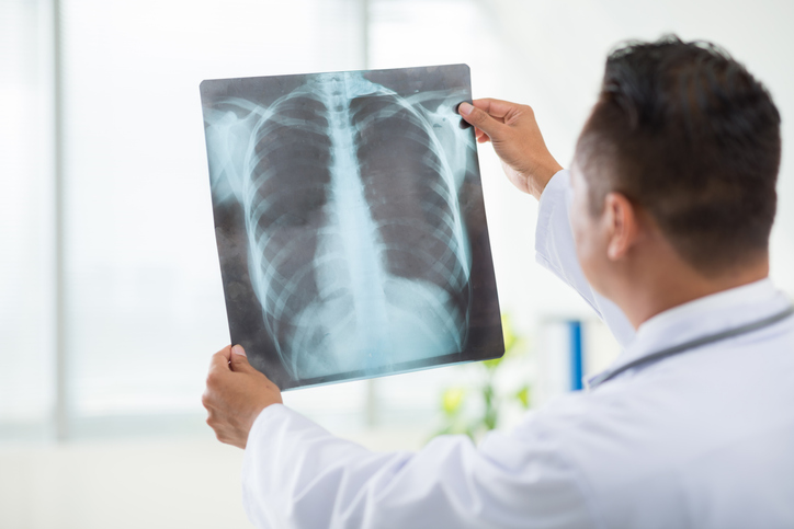 On Site X-rays thumbnail