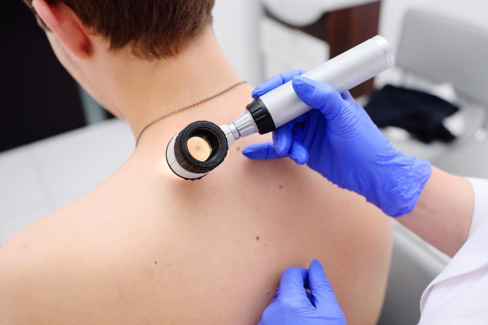 Skin Cancer Checks: What to Watch For thumbnail