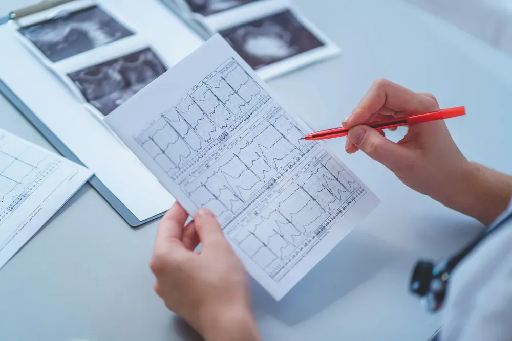 When Your Doctor Orders an EKG thumbnail