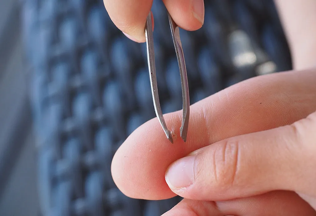 How to Handle a Splinter in a Wiggly Toddler thumbnail