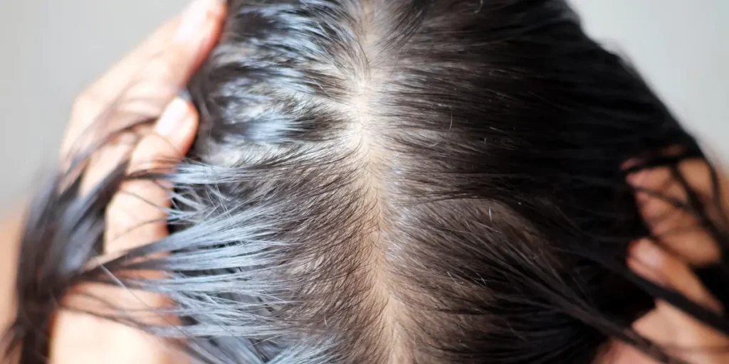 Does Wegovy cause hair loss? thumbnail