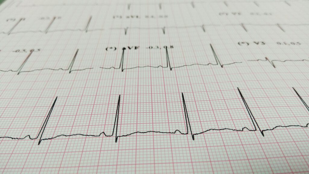 Integrating EKG Results into Your Treatment Plan thumbnail