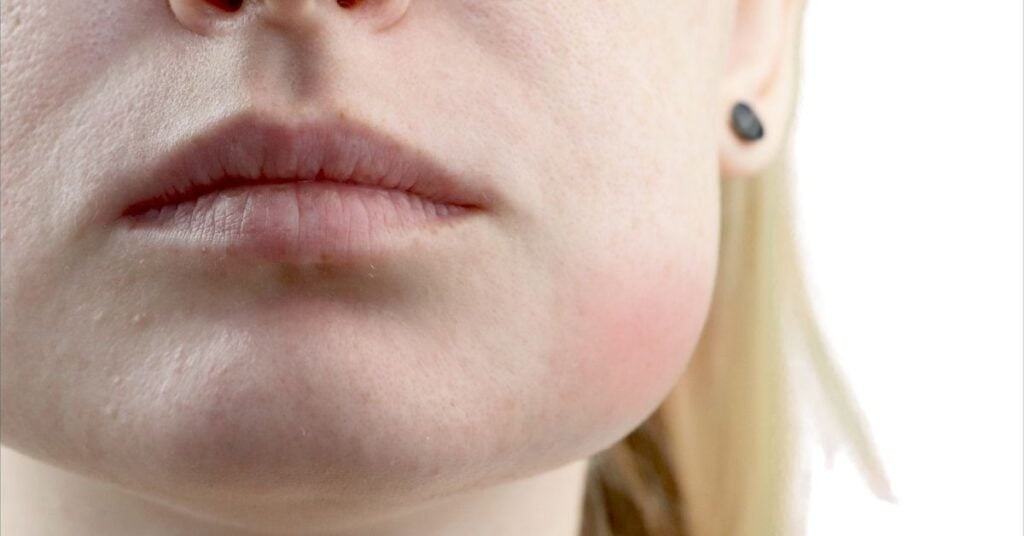 Facial Swelling After Injury: What’s Normal and What’s Not thumbnail