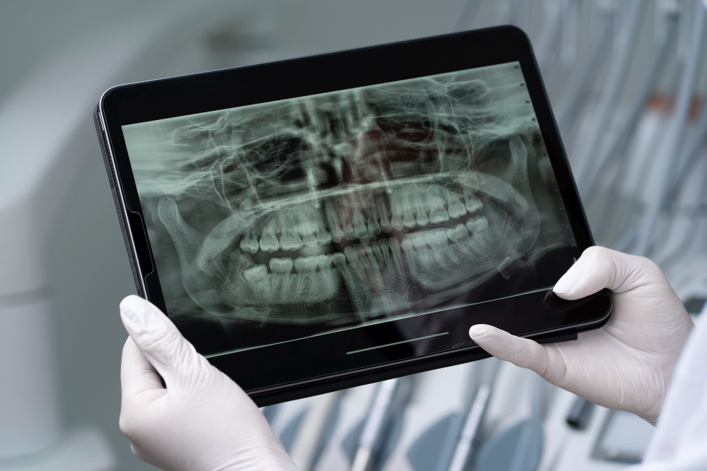 X‑Rays in Surgical Planning thumbnail