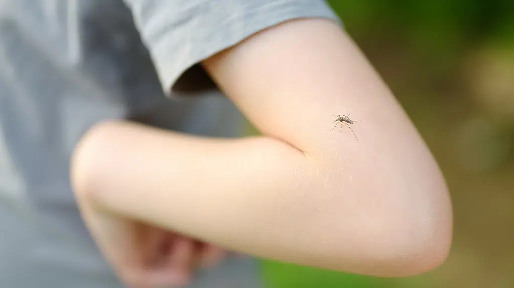Home Remedies for Ant Bites thumbnail