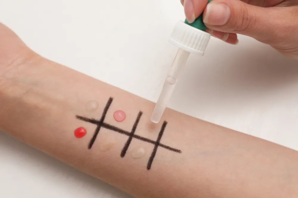 Allergy Screening Before Surgery thumbnail