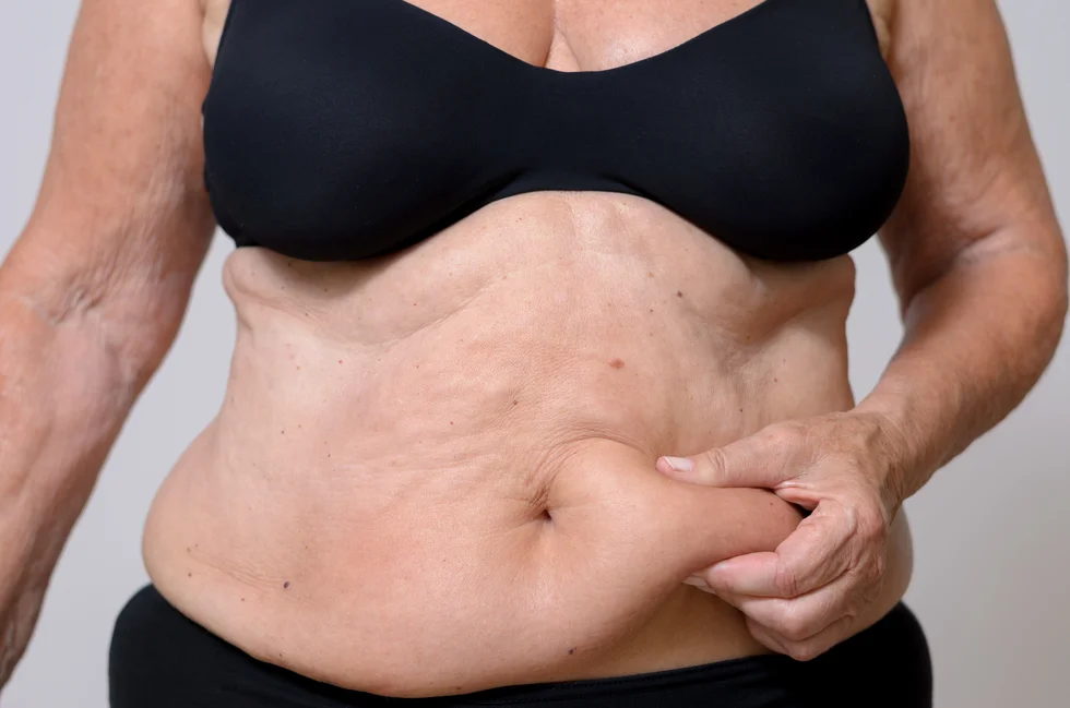 Why do older women’s stomachs stick out? thumbnail