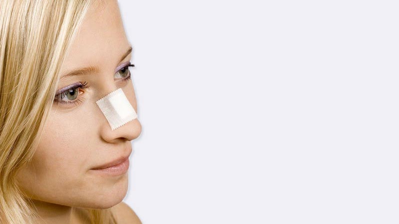 When to Worry About a Broken Nose thumbnail