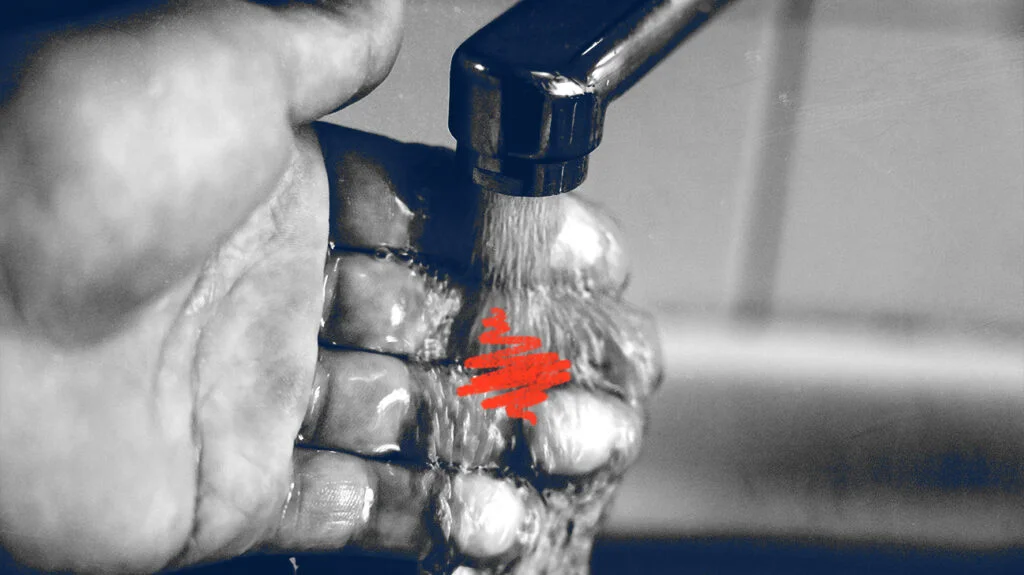 Common Burn Myths That Make Things Worse thumbnail