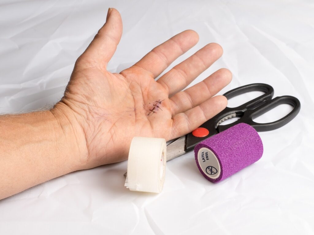 How to Treat a Minor Cut at Home (and When to Get Stitches) thumbnail