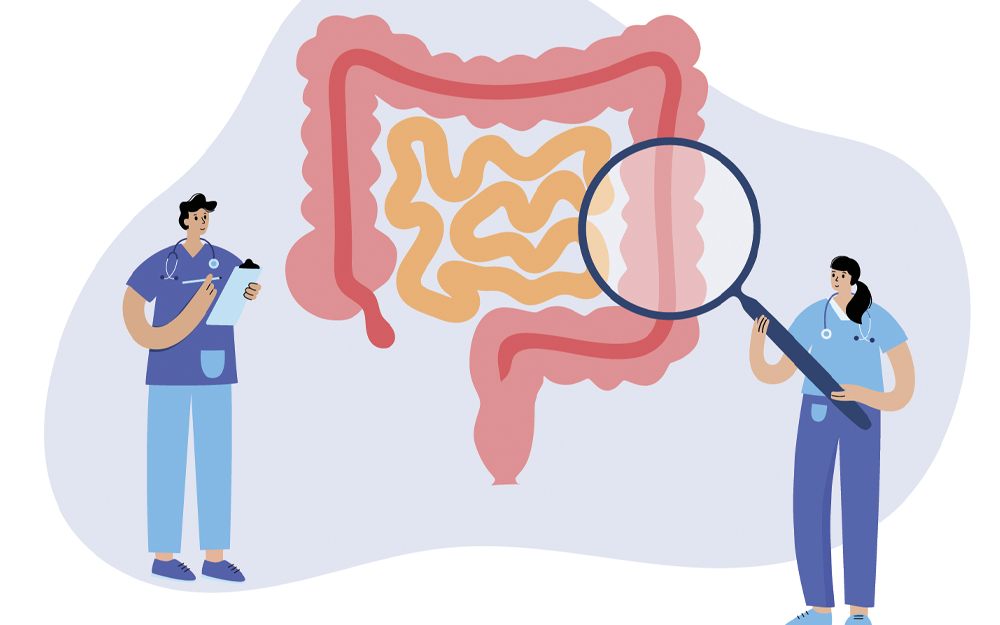 Screening for Colorectal Cancer thumbnail