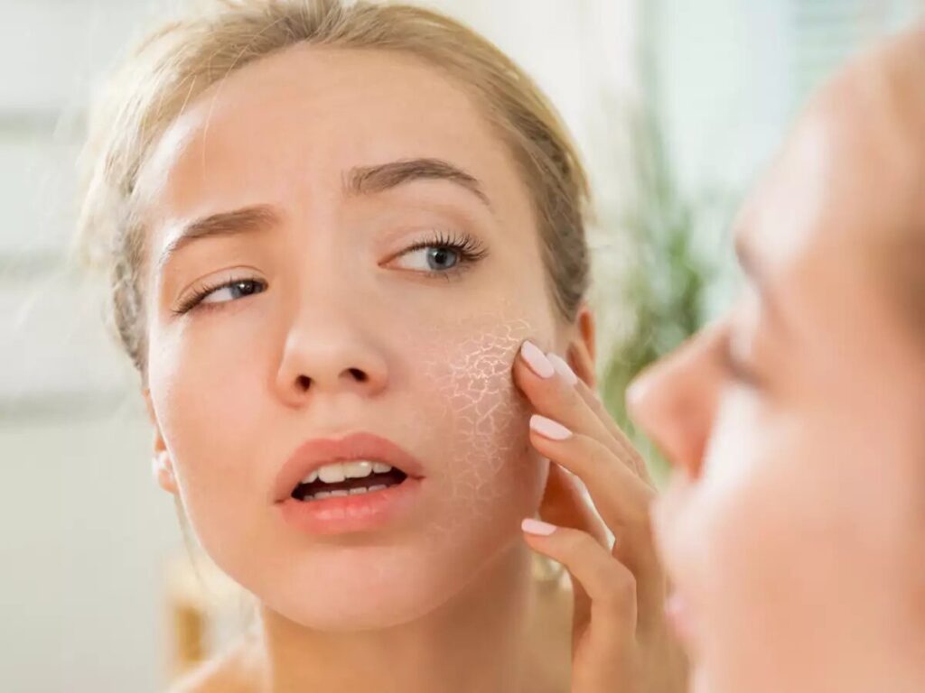 Natural Treatments for Dry, Cracked Skin thumbnail