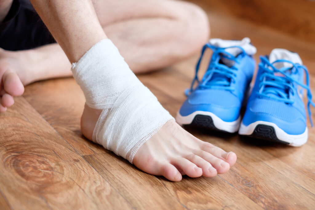 How to Treat a Minor Ankle Sprain at Home (R.I.C.E. Explained) thumbnail