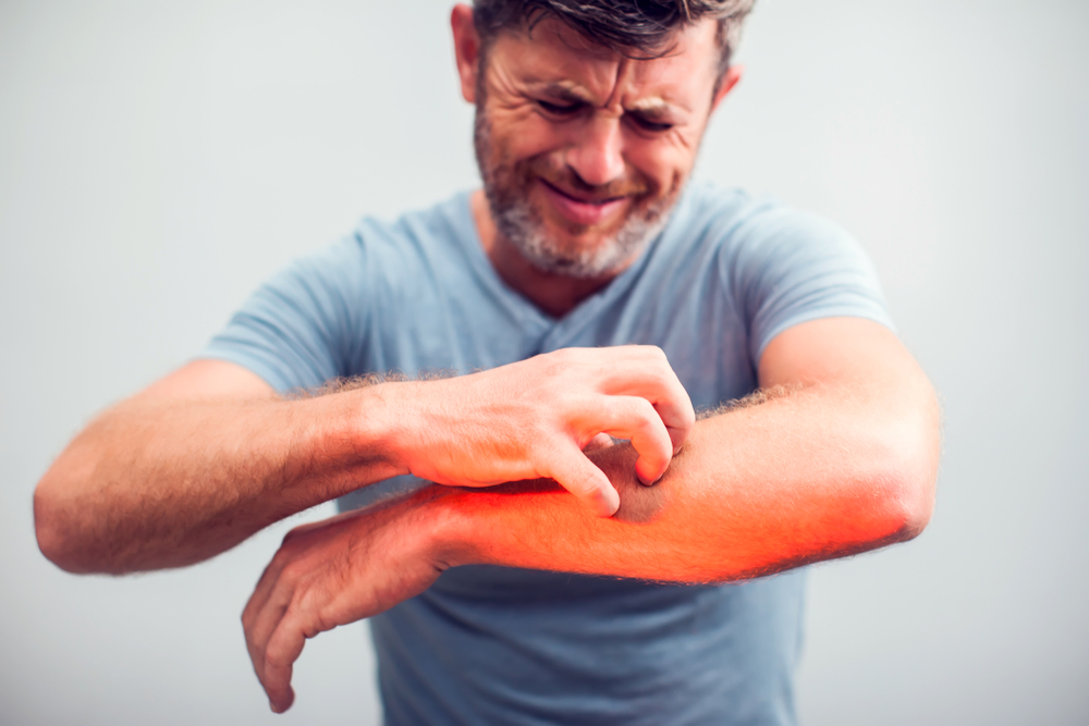 When Itchy Skin Is Something You Can Treat Yourself thumbnail