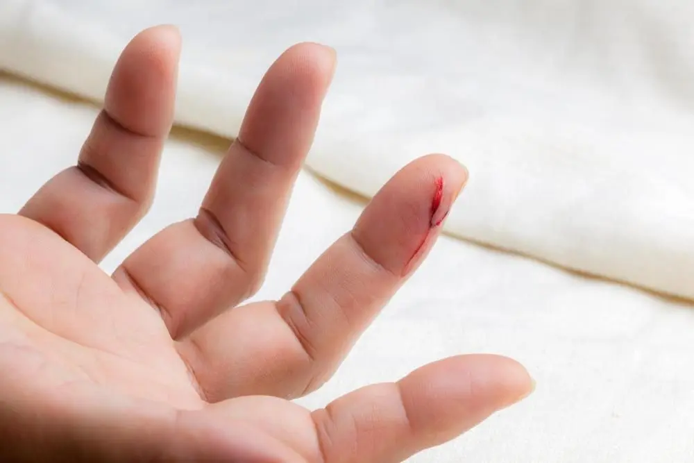 How to Treat a Minor Cut at Home (and When to Get Stitches) thumbnail