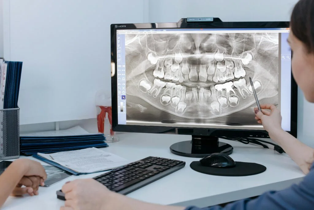 X‑Ray Safety Myths—Debunked thumbnail